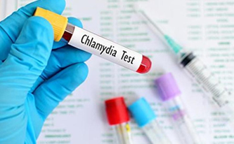 Chlamydia testing & treatment (NHS)